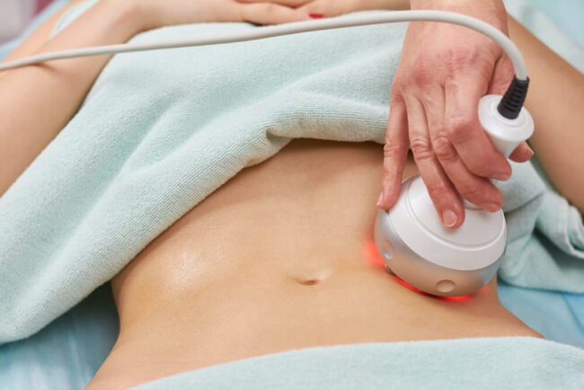 Introlift-Body-Sculpting-What-is-it-and-How-Does-it-Work-Stomach-2013398567