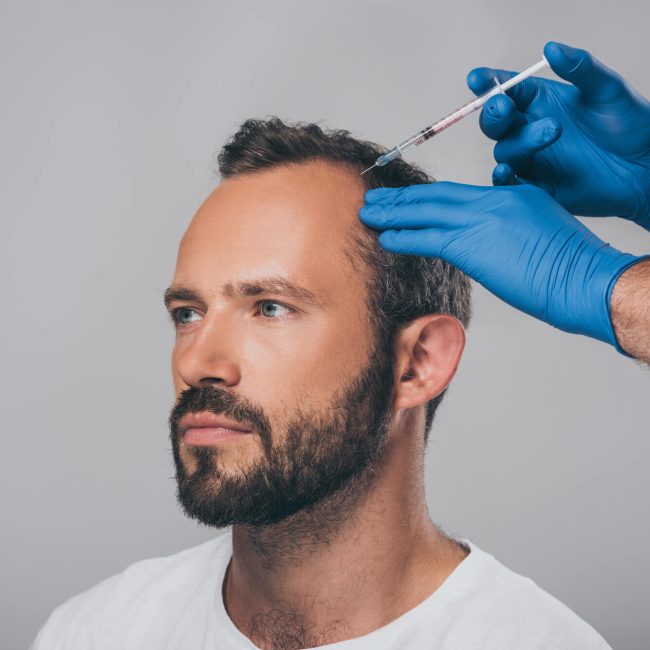 prp-hair-restoration-2287170555